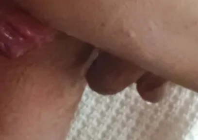 Prolapse and Urine