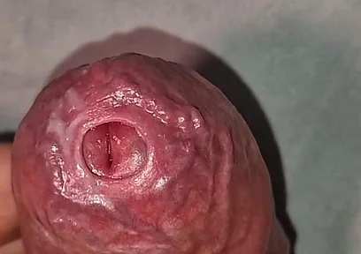Close up on Phimosis Large Cock, so Hot!