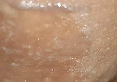 Scrotal Phimosis Results in an Extremely Hot Orgasm.
