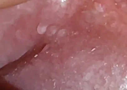 Super Daddy Enlarged Hole Pulsing with Horniness.