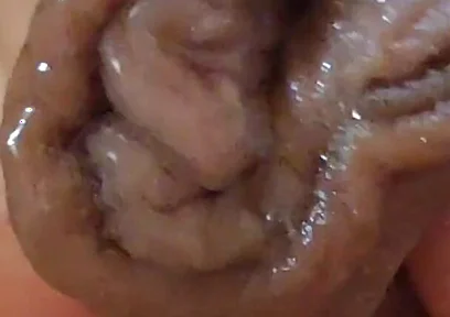 Large Foreskin and Balls in Striking Close-up.